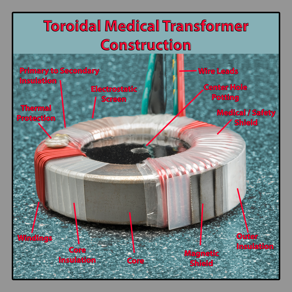 Toroidal medical transformer construction